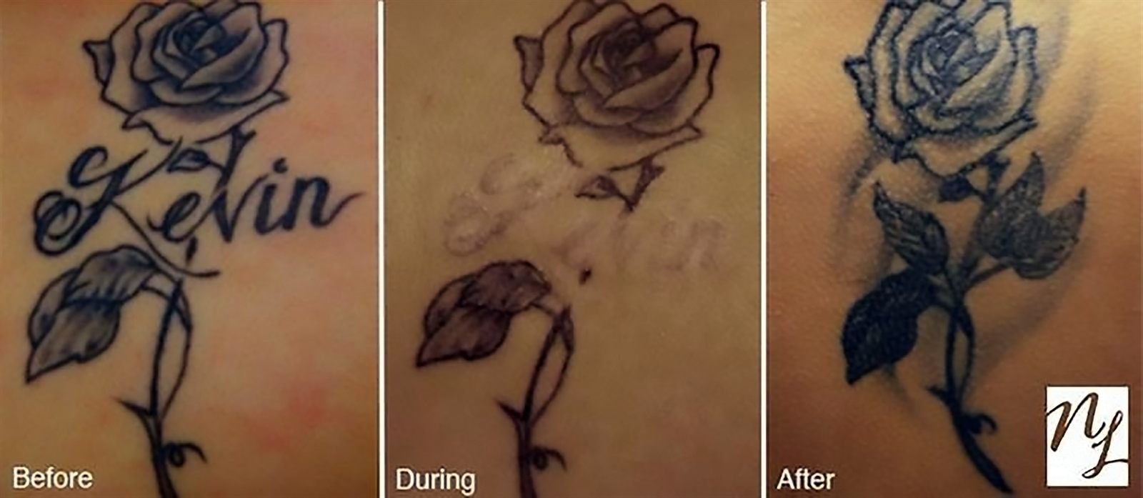 Tatuaje de rosa antes, durante y después del tratamiento